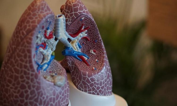 AI solutions to detect lung cancer