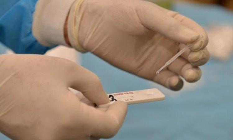 Dry-RT-PCR