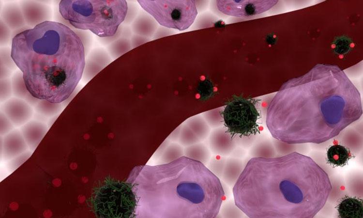 Science-Heat treatment-Chemotherapy