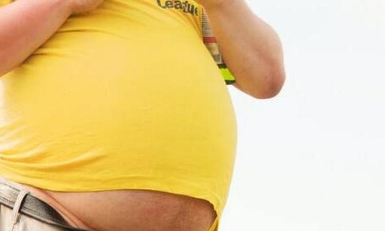 Obesity-Lifestyle-Fat-AMU
