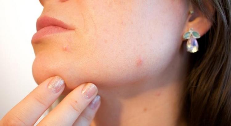 Skin problems