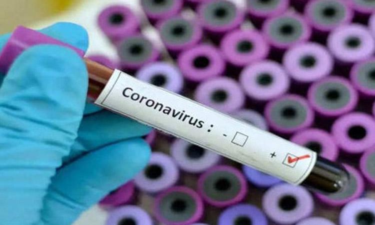 Covid 19, Covid 19 symtoms, Covid 19 vaccination, Why some patients test positive for Covid long after recovery, Covid 19 recovery