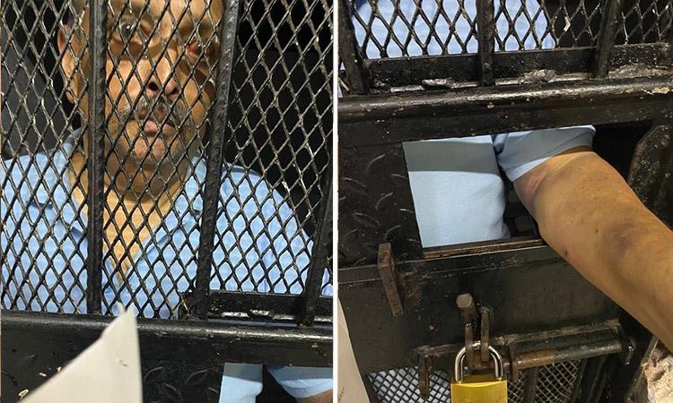 Mehul Choksi, Mehul Choksi case, Mehul Chuksi pictures, New pictures of Mehul Choksi emerge, show injury marks