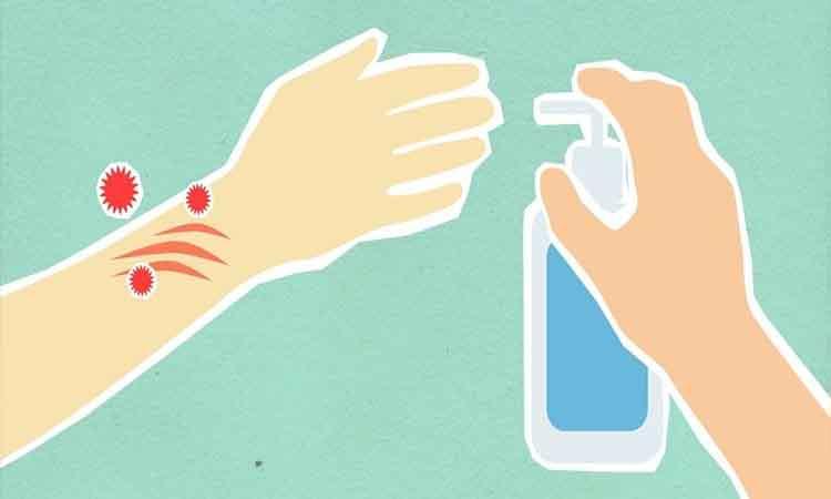 Hand-Sanitizers