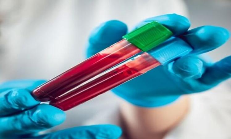 India's-top-cancer-facility-TMC-Mumbai-appeals-for-blood
