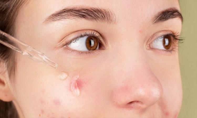 The-importance-of-cleaning-clogged-pores