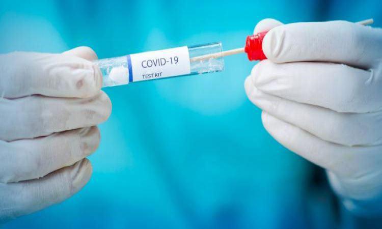 Covid-19-Test