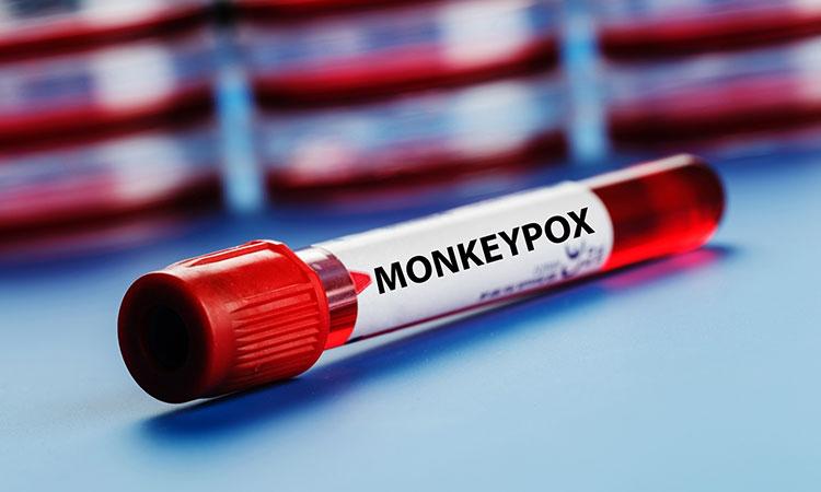 Monkeypox-US