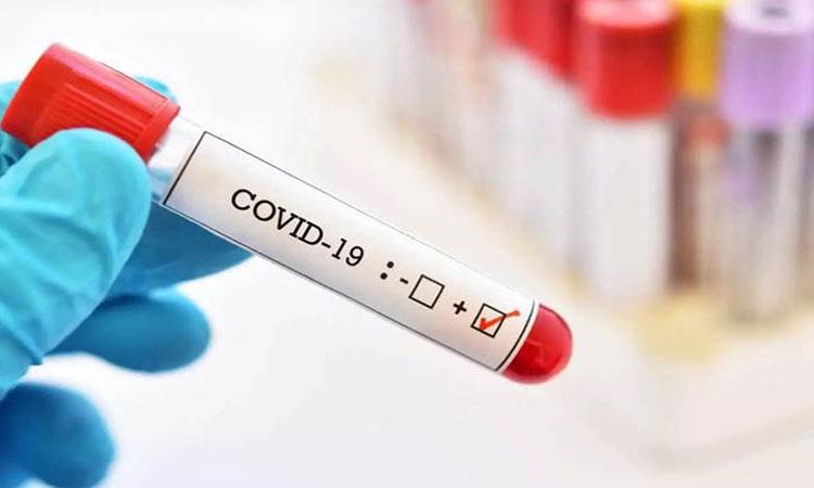 Covid-19-Virus