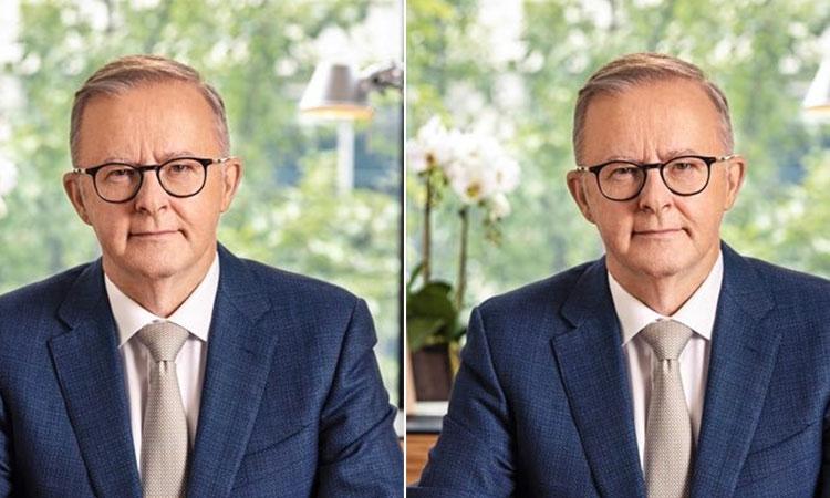 Anthony-Albanese