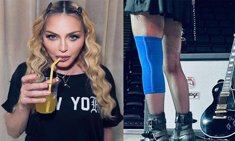 Madonna-wears-knee-brace-in-pics-from-rehearsals