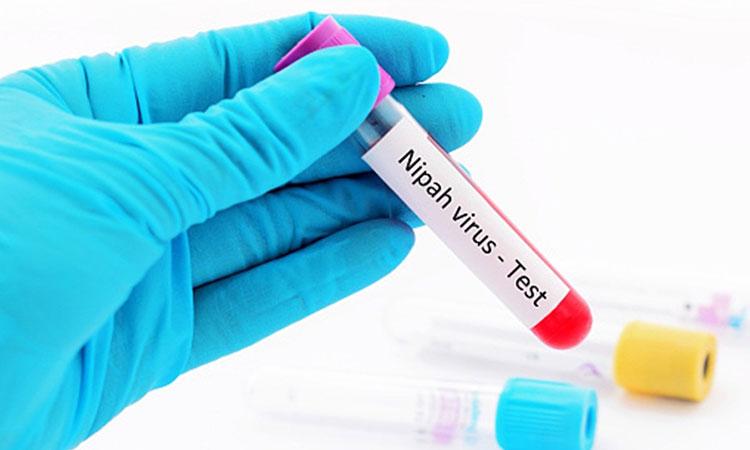 Nipah-Virus-Test