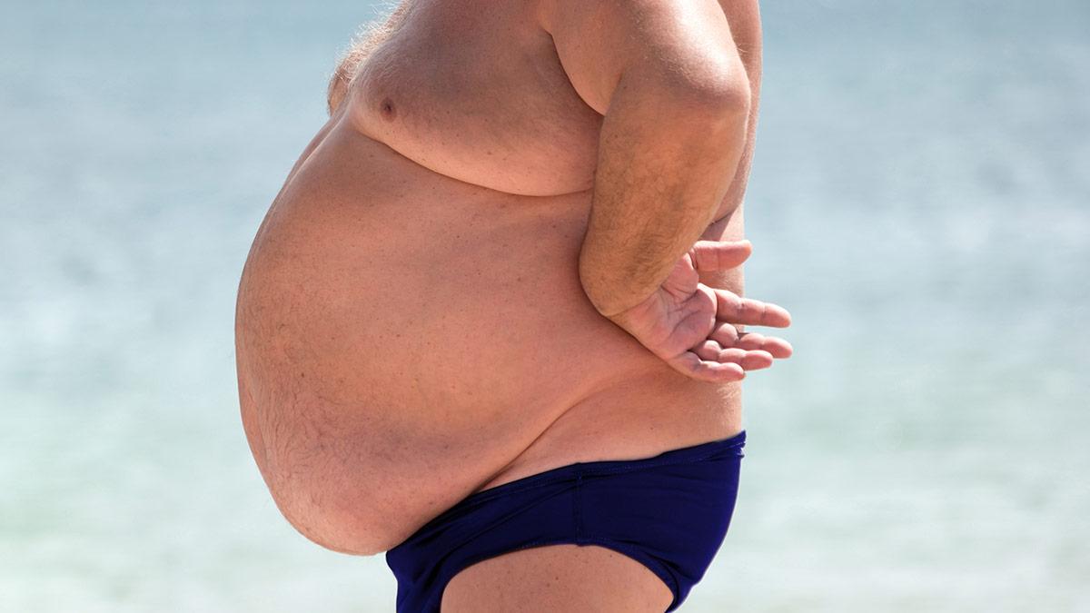 Study Links Obesity to Anxiety and Reduced Brain Function